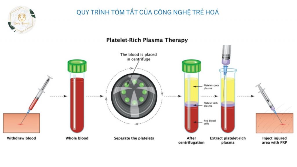 Quy trình tóm tắt công nghệ trẻ hóa PRP